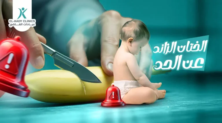 الختان الزائد عن الحد