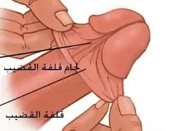 شكل الختان الصحيح للذكور