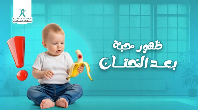 ما هي أسباب ظهور حبة بعد الختان؟