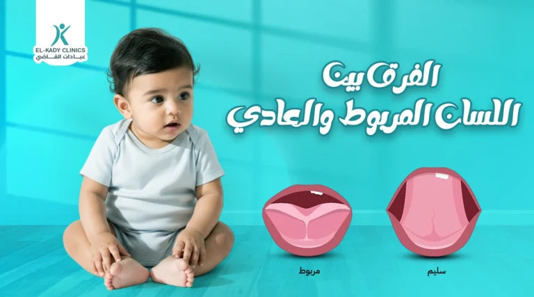 تعرف على الفرق بين اللسان المربوط والعادي بالصور