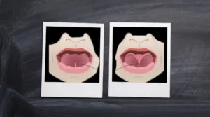 درجات اللسان المربوط بالصور عند الأطفال