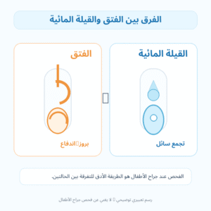 شكل فتق الخصية عند الاطفال بالصور التوضيحية