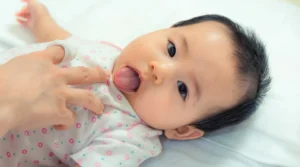 صور اللسان المربوط عند الرضع