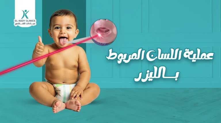 دليلك الشامل لعملية اللسان المربوط بالليزر وتكلفتها في مصر