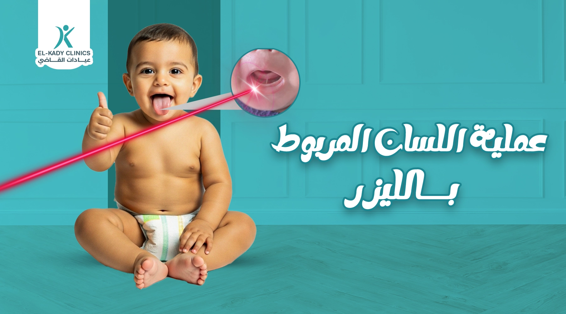 دليلك الشامل لعملية اللسان المربوط بالليزر وتكلفتها في مصر