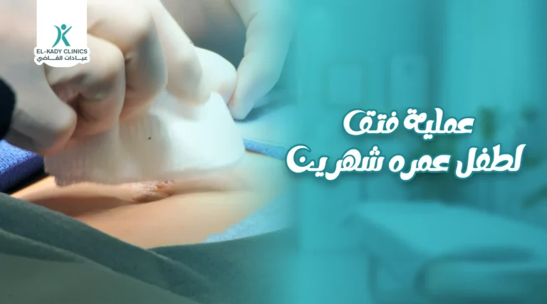 عملية فتق لطفل عمره شهرين