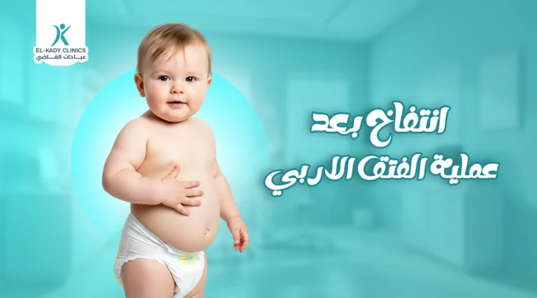 5 أسباب ظهور انتفاخ بعد عملية الفتق الإربي للأطفال