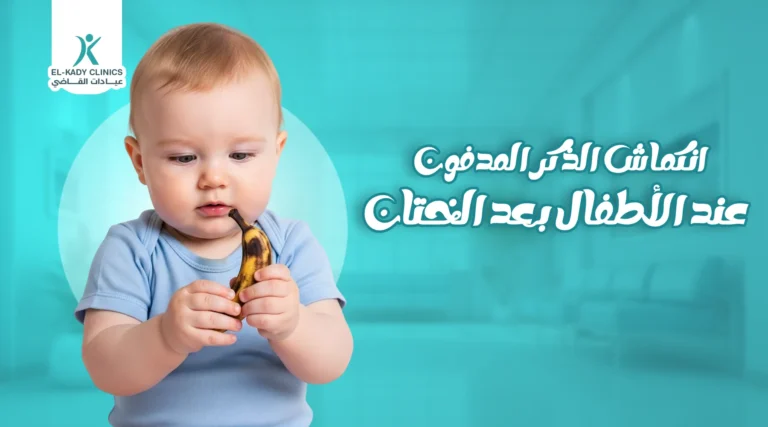 أسباب انكماش الذكر المدفون عند الأطفال بعد الختان وعلاجه