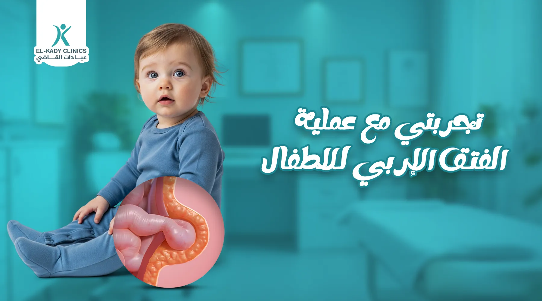 تجربتي مع عملية الفتق الإربي للأطفال لدى الدكتور رضا القاضي