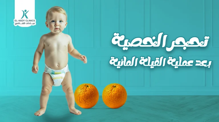 تحجر الخصية بعد عملية القيلة المائية