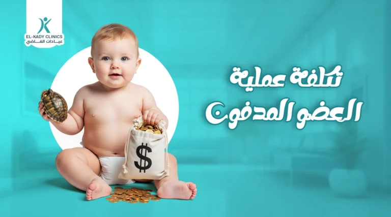 ما هي تكلفة عملية العضو المدفون 2026؟