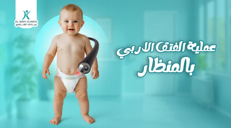 عملية الفتق الإربي بالمنظار: الخطوات ومميزاتها في مصر