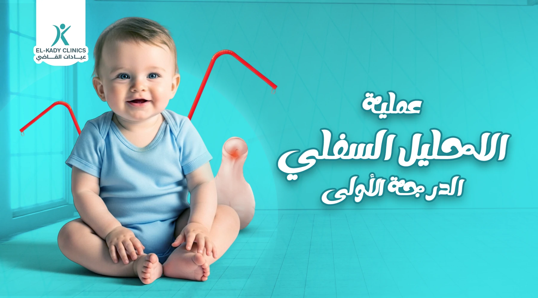 عملية الإحليل السفلي الدرجة الأولى: الخطوات والنتائج