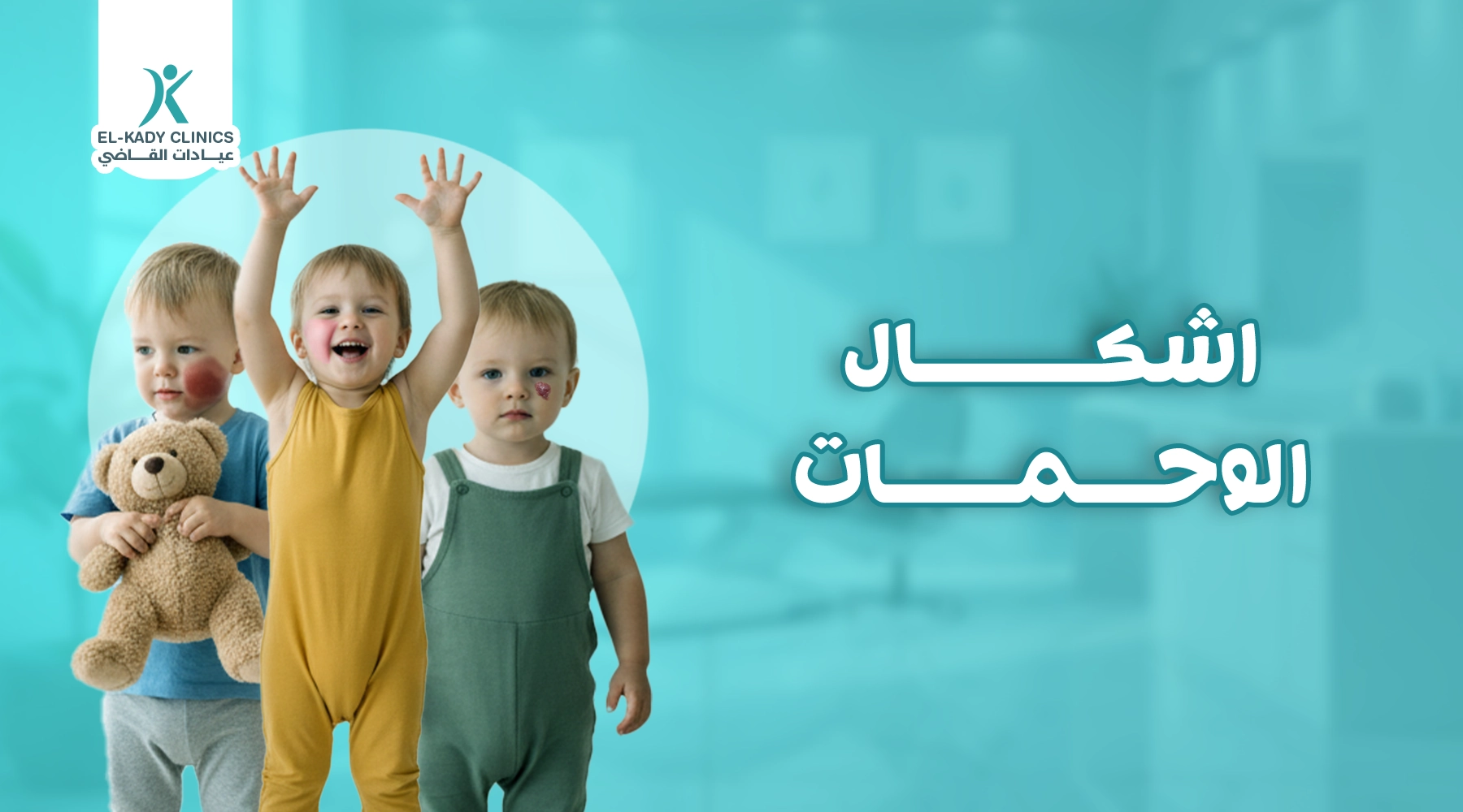 أشكال الوحمات بالصور