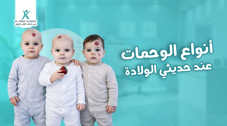 أنواع الوحمات عند حديثي الولادة بالصور