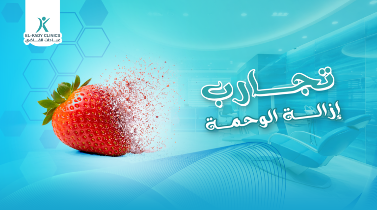 أبرز تجارب إزالة الوحمة عند الأطفال مع الدكتور رضا 2026