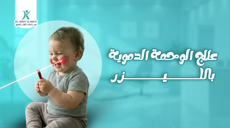 علاج الوحمة الدموية بالليزر