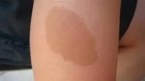 وحمة القهوة بالحليب