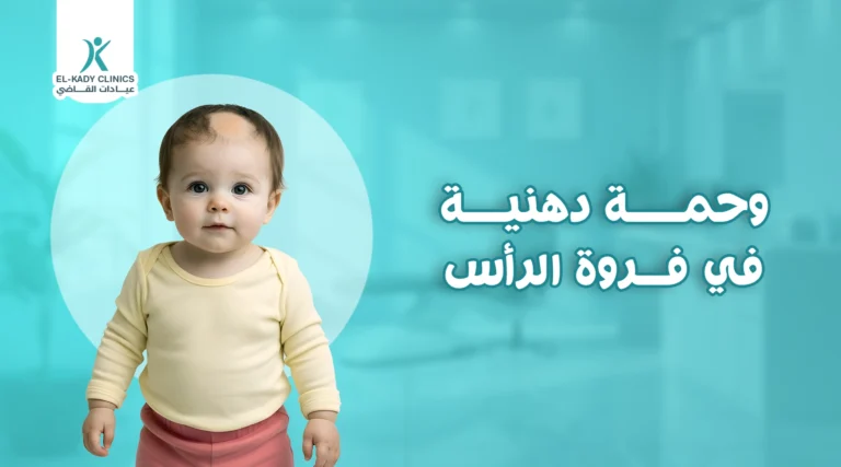 شكل الوحمة الدهنية في الرأس وأسبابها وعلاجها