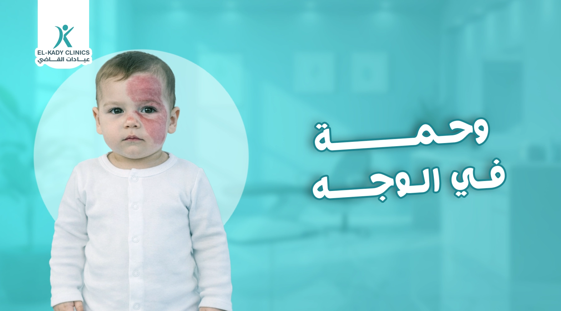 وحمة في الوجه: أسبابها وأعراضها لدى الأطفال