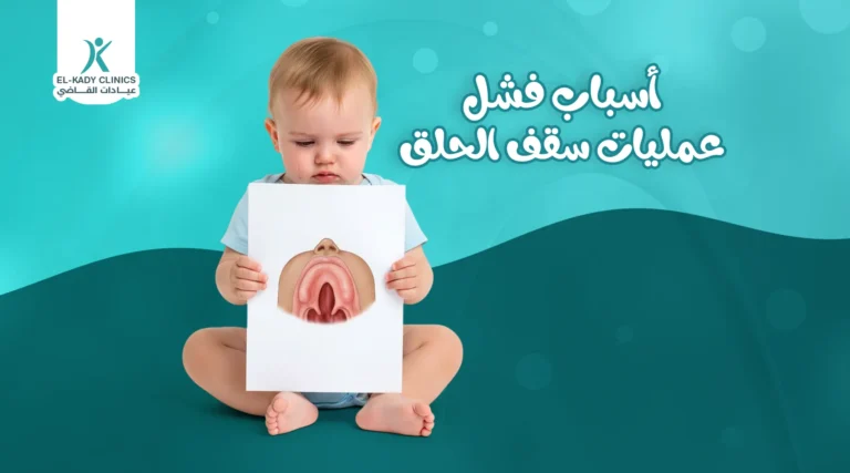 أسباب فشل عمليات سقف الحلق المشقوق
