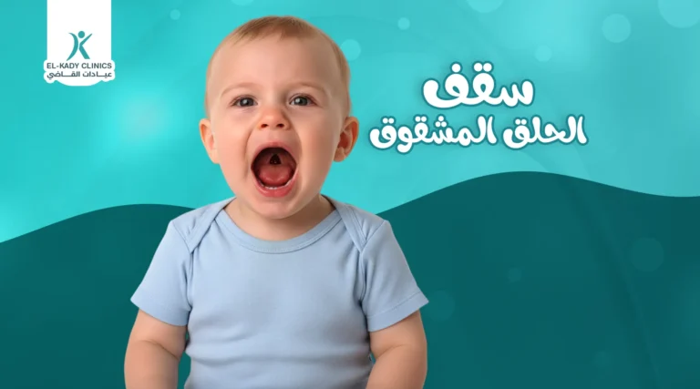 سقف الحلق المشقوق وشكل سقف الحلق الطبيعي عند الرضع