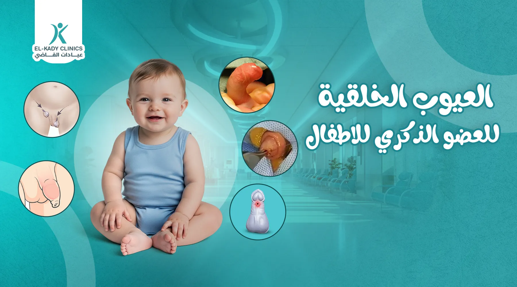 العيوب الخلقية للعضو الذكري للأطفال