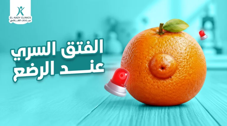 الفتق السري عند الرضع