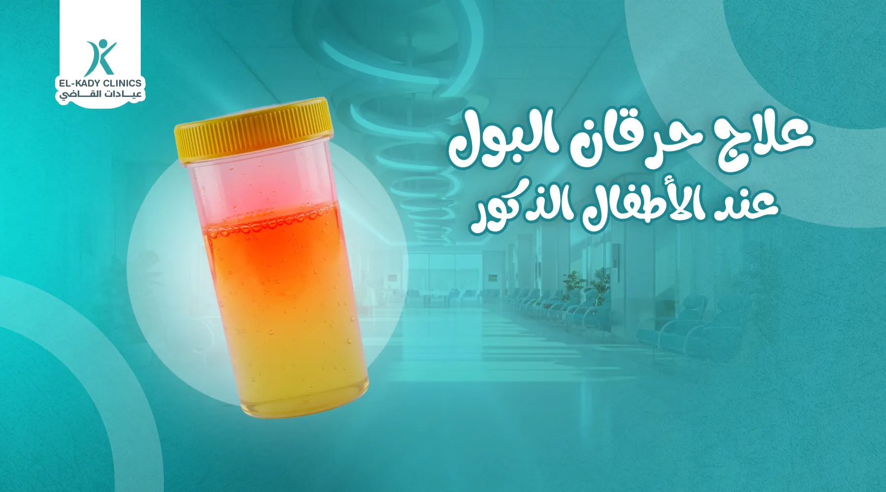 علاج حرقان البول عند الأطفال الذكور