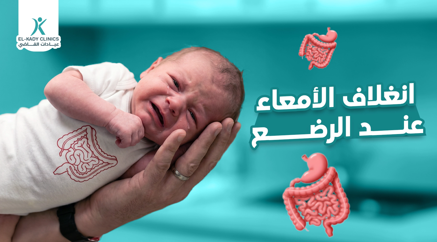 انغلاف الأمعاء عند الرضع