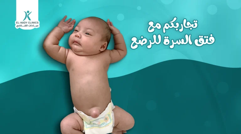 تجاربكم مع فتق السرة للرضع مع د رضا القاضي