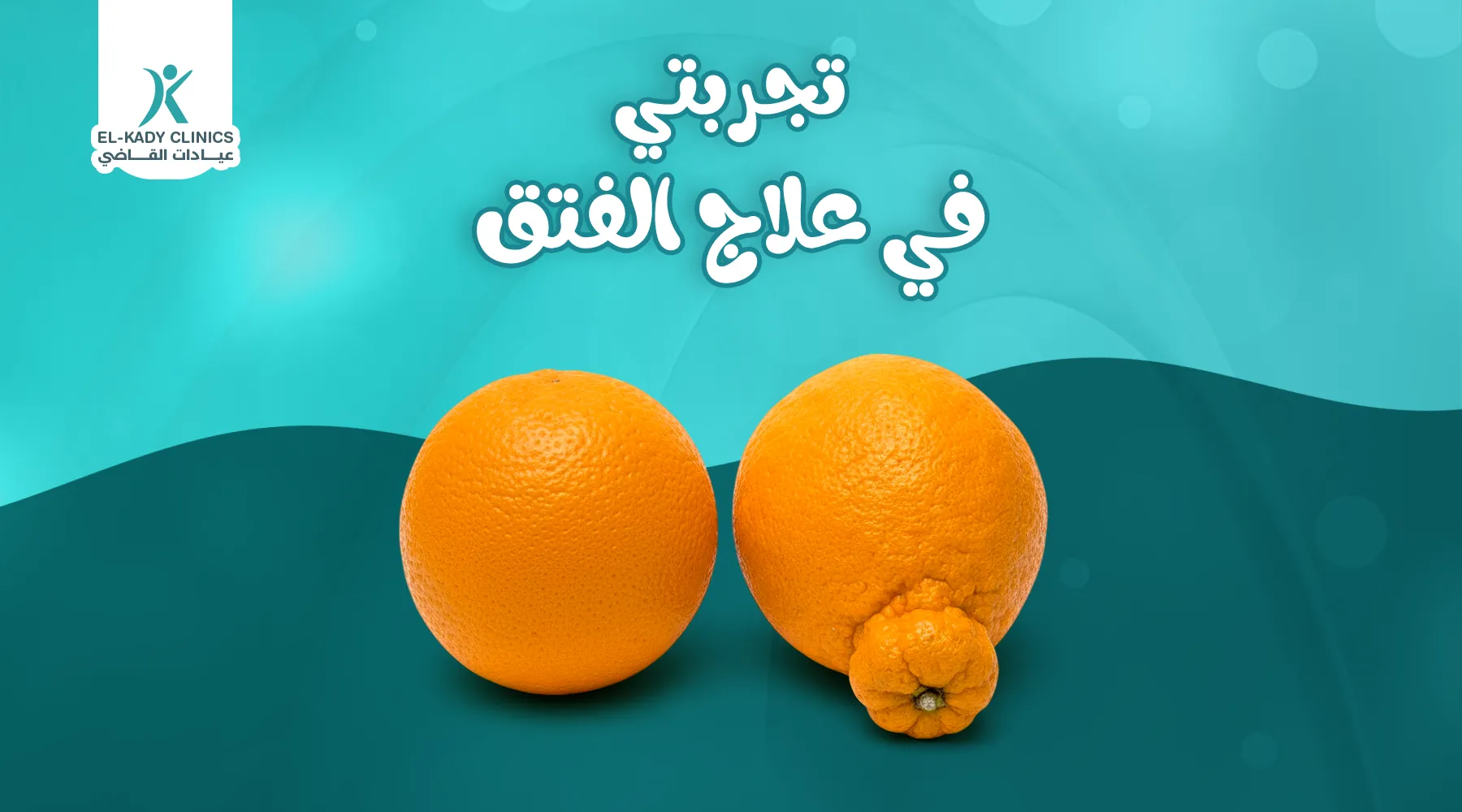 تجربتي في علاج الفتق
