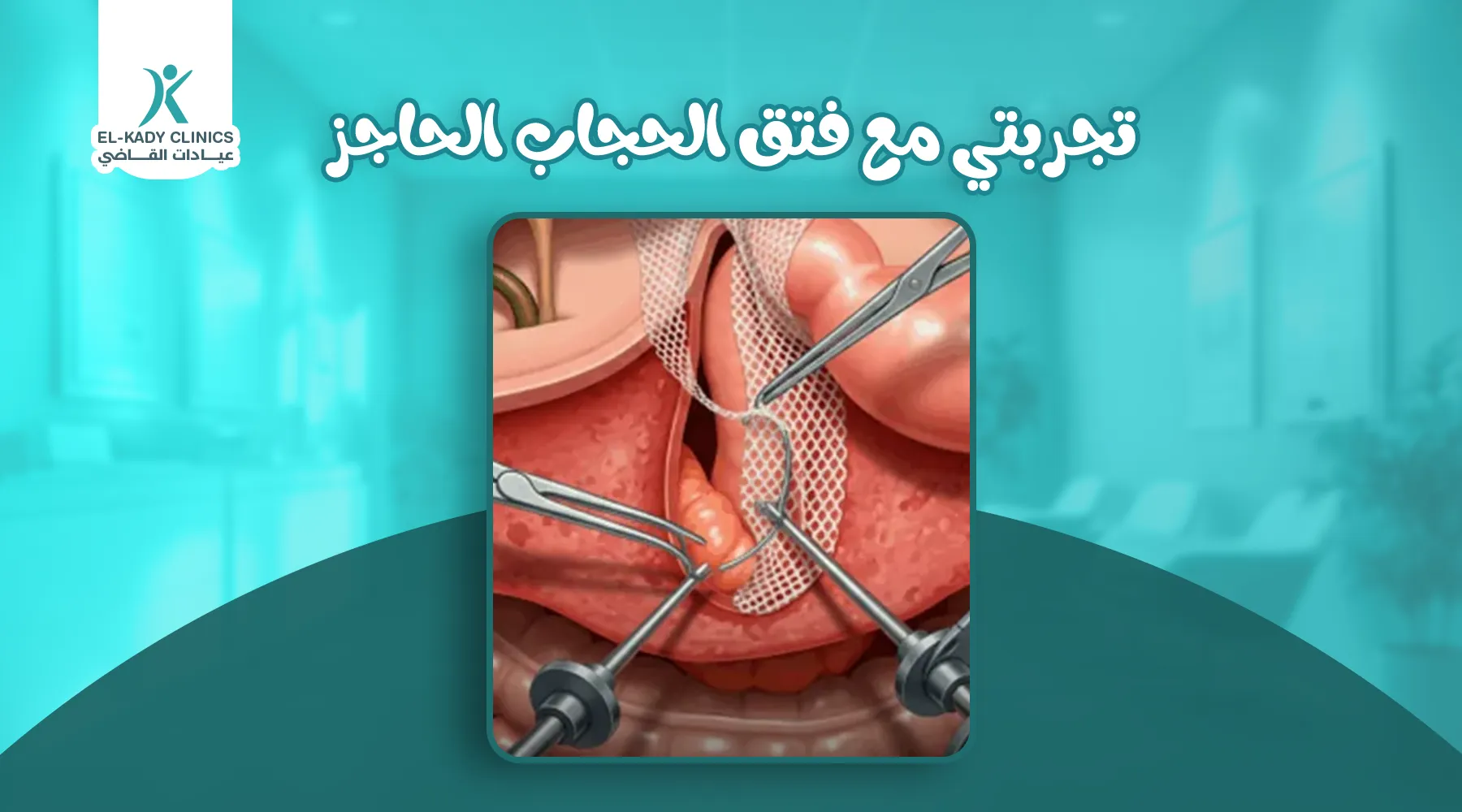 تجربتي مع فتق الحجاب الحاجز للأطفال