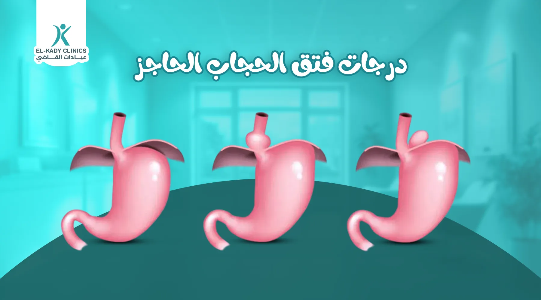 درجات فتق الحجاب الحاجز عند الأطفال