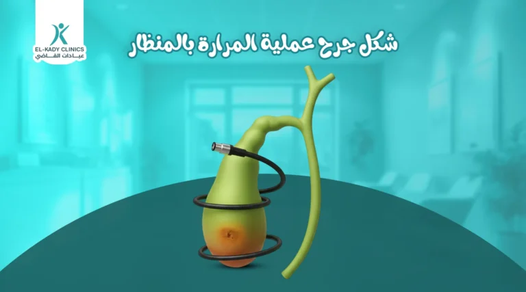 شكل جرح عملية المرارة بالمنظار للأطفال
