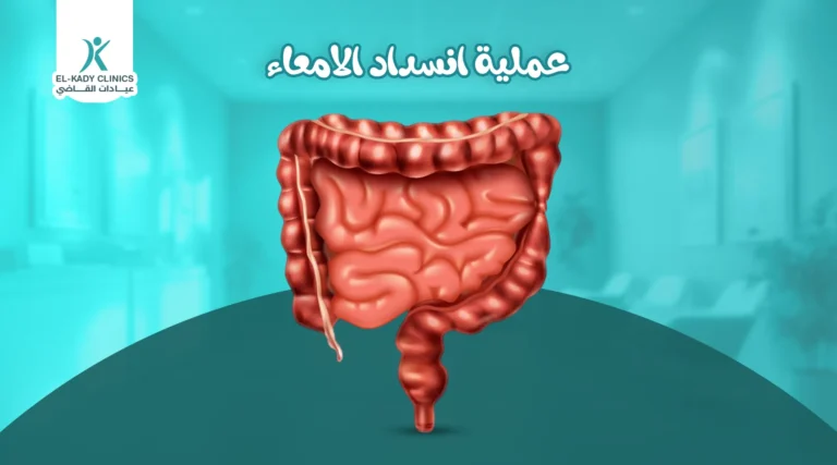 عملية انسداد الأمعاء