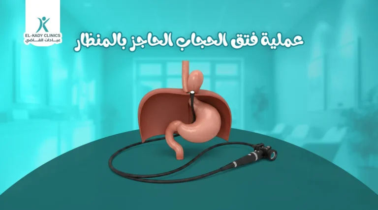 عملية فتق الحجاب الحاجز بالمنظار للأطفال: الخطوات والنتائج