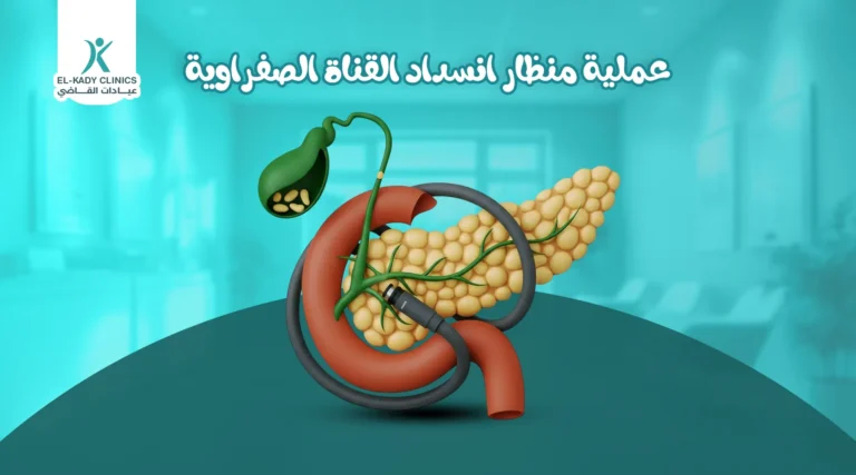 عملية منظار انسداد القناة الصفراوية للأطفال
