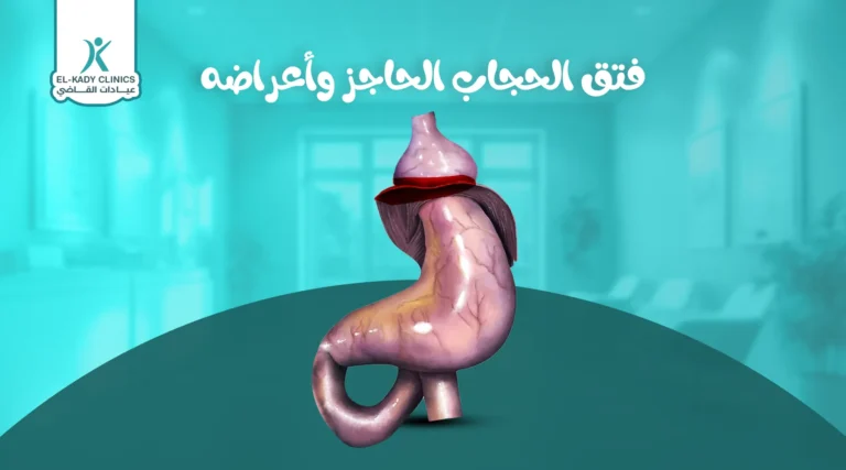 فتق الحجاب الحاجز وأعراضه عند الأطفال