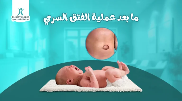 ما بعد عملية الفتق السري: أهم نصائح بعد عملية الفتق السري