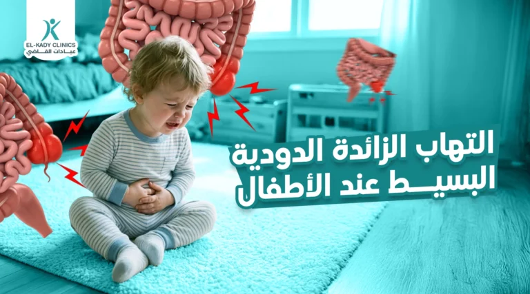 التهاب الزائدة الدودية البسيط عند الأطفال