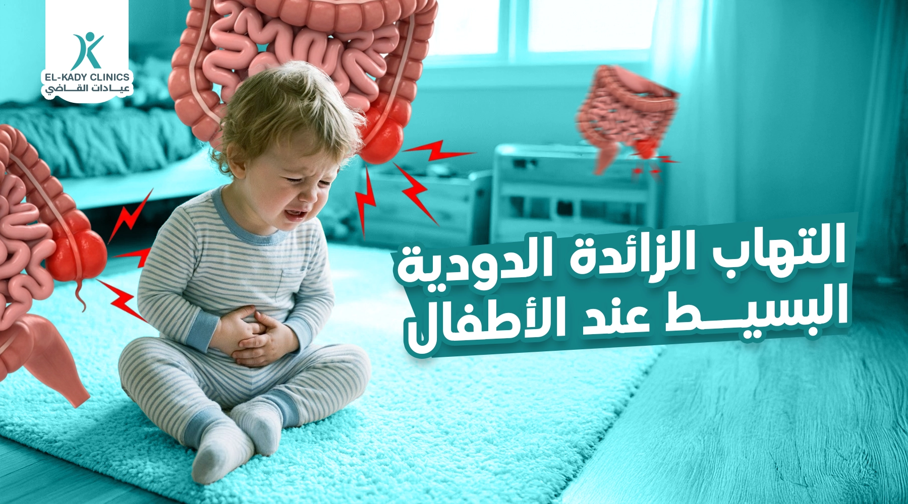 التهاب الزائدة الدودية البسيط عند الأطفال