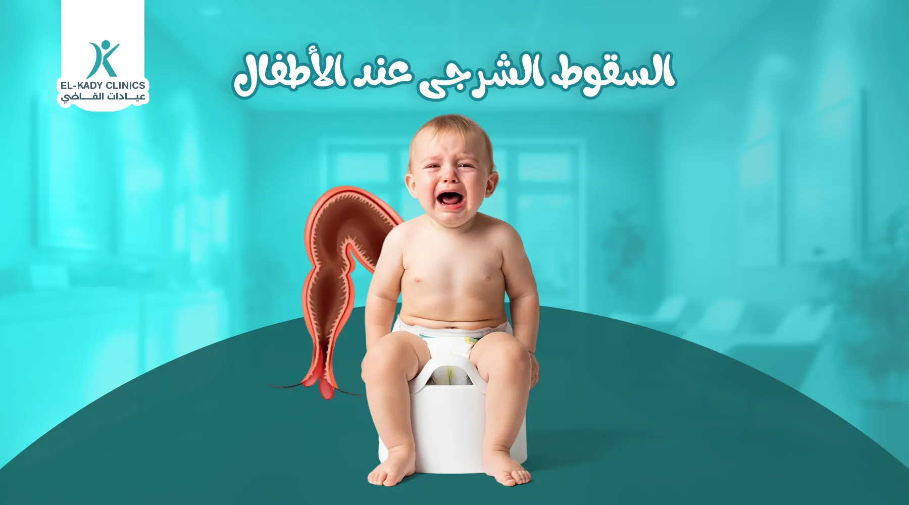 السقوط الشرجي عند الأطفال