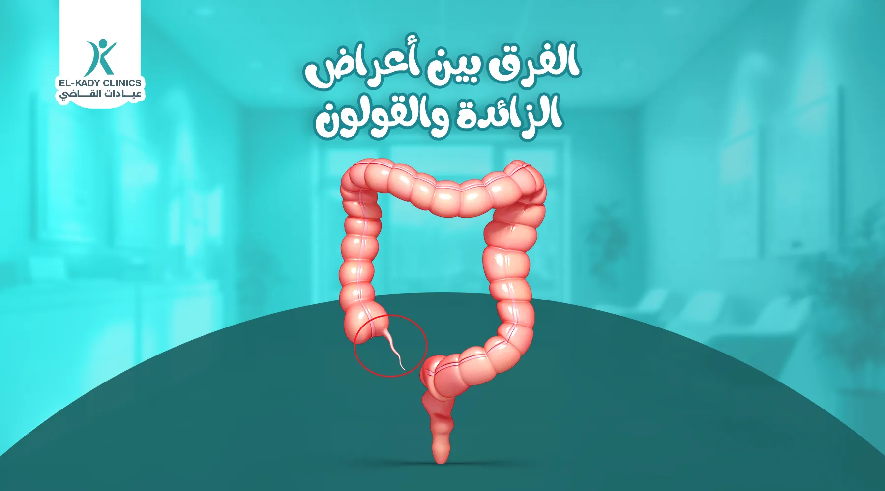 الفرق بين أعراض الزائدة والقولون