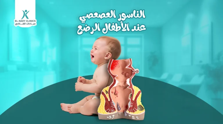 الناسور العصعصي عند الأطفال الرضع وعلاجه