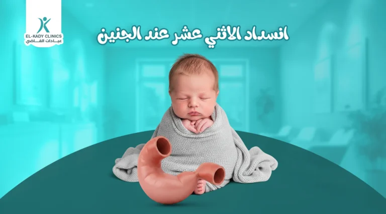 انسداد الاثني عشر عند الجنين
