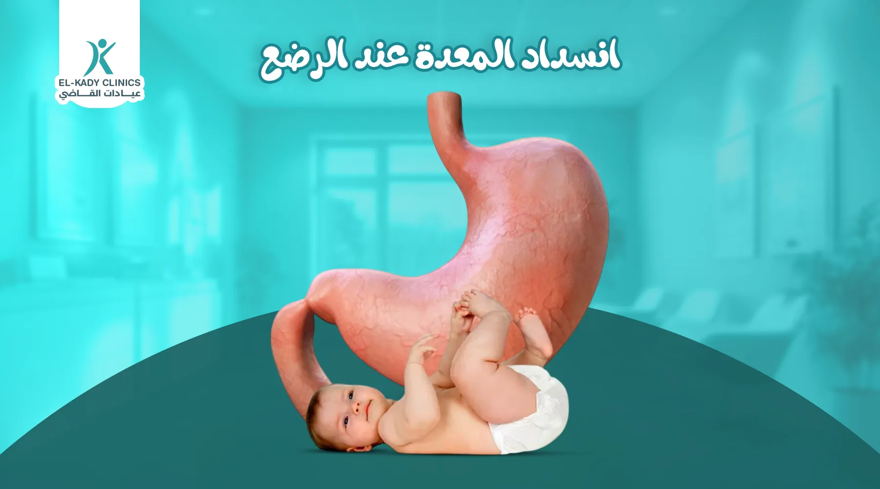انسداد المعدة عند الرضع