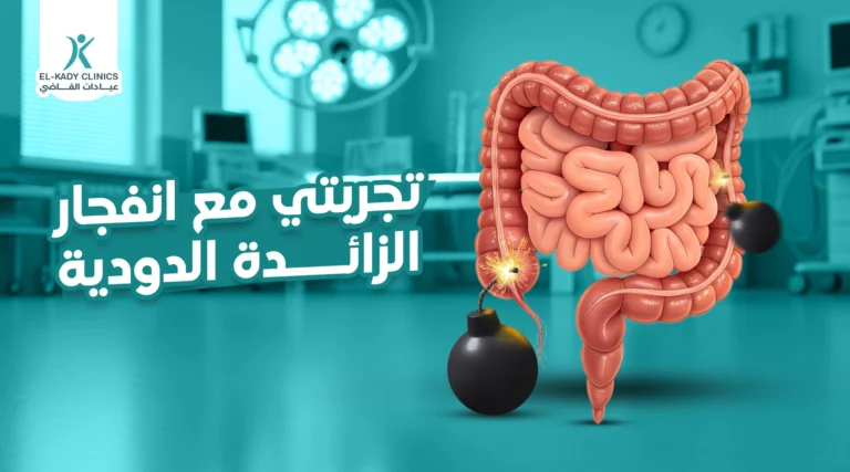 تجربتي مع انفجار الزائدة الدودية