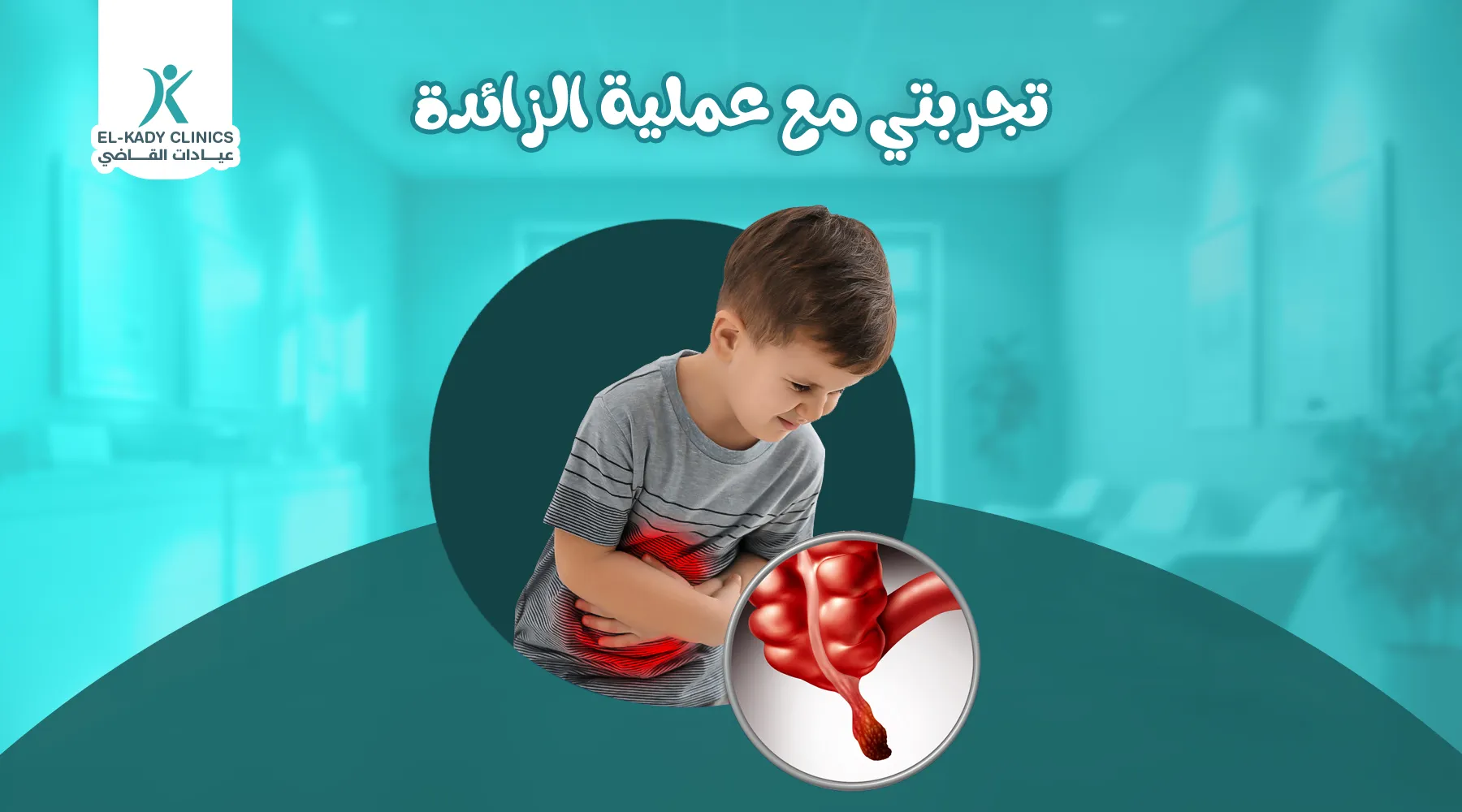تجربتي مع عملية الزائدة