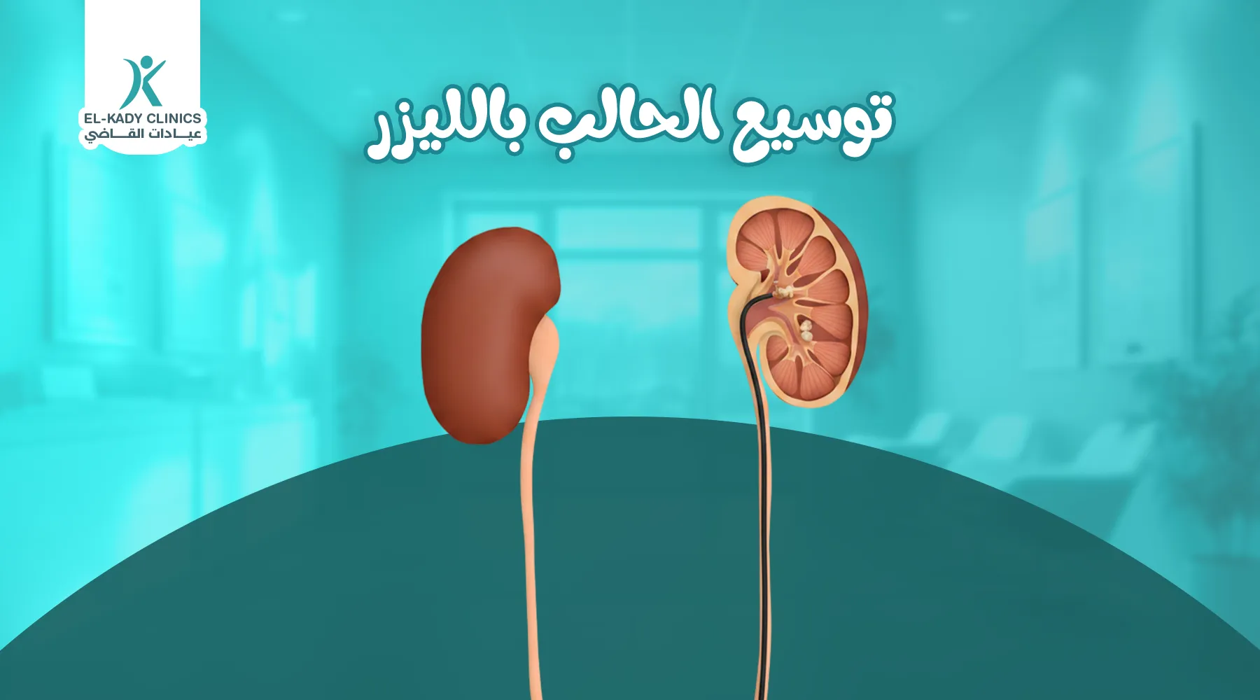 توسيع الحالب بالليزر للرضع